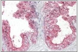 Image no. 1 for anti-Kallikrein 2 (KLK2) (Internal Region) antibody (ABIN374827) (Kallikrein 2 Antikörper  (Internal Region))