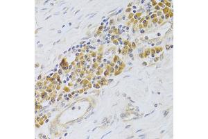 Immunohistochemistry of paraffin-embedded human esophagus using PA2G4 Antibody (ABIN1876564) at dilution of 1:100 (40x lens). (PA2G4 Antikörper)