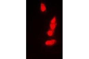 Immunofluorescent analysis of PSMB8 staining in A549 cells.