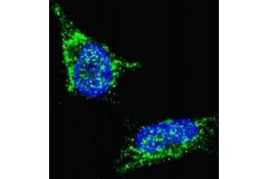 Fluorescent confocal image of SY5Y cells stained with LIN28B antibody.