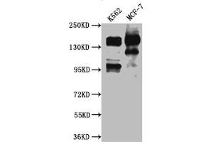 Western Blot Positive WB detected in: K562 whole cell lysate, MCF-7 whole cell lysate All lanes: mSin3A antibody at 1:1000 Secondary Goat polyclonal to rabbit IgG at 1/50000 dilution Predicted band size: 146 kDa Observed band size: 146 kDa (Rekombinanter SIN3A Antikörper)