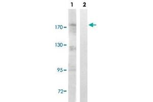 Western blot analysis of Lane 1: Untreated Jurkat cell lysates, Lane 2: Synthesized peptide treated Jurkat cell lysates reacted with TOP2A (phospho S1106) polyclonal antibody  at 1:500-1:3000 dilution. (Topoisomerase II alpha Antikörper  (pSer1106))