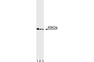 Western Blotting (WB) image for anti-Glutamate Decarboxylase 2 (Pancreatic Islets and Brain, 65kDa) (GAD2) antibody (ABIN967657) (GAD65 Antikörper)