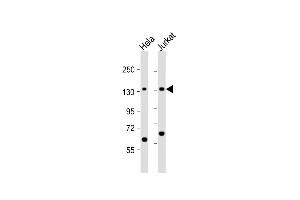 All lanes : Anti-SF3B3 Antibody (C-term) at 1:1000 dilution Lane 1: Hela whole cell lysate Lane 2: Jurkat whole cell lysate Lysates/proteins at 20 μg per lane.