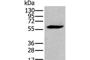 Western blot analysis of LNCAP cell lysate using EGR2 Polyclonal Antibody at dilution of 1:300 (EGR2 Antikörper)