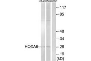 Western blot analysis of extracts from HT-29/K562 cells, using HOXA6 Antibody. (HOXA6 Antikörper  (AA 101-150))