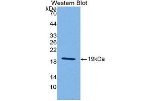 Western Blotting (WB) image for anti-Sonic Hedgehog (SHH) (AA 28-192) antibody (ABIN1175088) (Sonic Hedgehog Antikörper  (AA 28-192))
