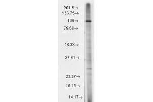 Western Blot analysis of Rat brain membrane lysate showing detection of TrpC7 protein using Mouse Anti-TrpC7 Monoclonal Antibody, Clone S64A-36 . (TRPC7 Antikörper  (AA 845-862))