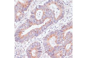 Immunohistochemistry (IHC) image for anti-RAP1A, Member of RAS Oncogene Family (RAP1A) (AA 50-150) antibody (ABIN3021200)