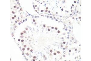 Immunohistochemistry (Paraffin-embedded Sections) (IHC (p)) image for anti-Myc Proto-Oncogene protein (MYC) (pSer62) antibody (ABIN7265076)