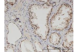 Image no. 1 for anti-Mediator Complex Subunit 6 (MED6) (AA 1-247) antibody (ABIN599504) (MED6 Antikörper  (AA 1-247))