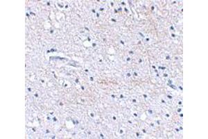 Immunohistochemical staining of human brain tissue using FBXL20 polyclonal antibody  at 2. (FBXL20 Antikörper  (C-Term))