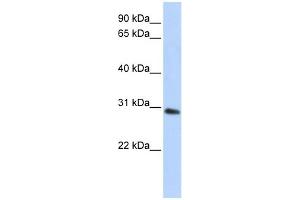 WB Suggested Anti-BPGM Antibody Titration: 0. (BPGM Antikörper  (C-Term))
