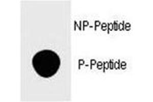 Dot blot analysis of phospho-FOXP3 antibody.
