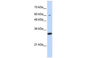 LRRC57 antibody used at 1 ug/ml to detect target protein. (LRRC57 Antikörper  (N-Term))