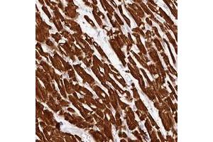 Immunohistochemical staining of human heart muscle with MYH15 polyclonal antibody  shows strong cytoplasmic positivity in myocytes.