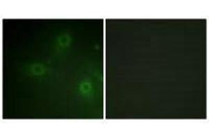 Immunofluorescence analysis of HeLa cells, using Neutrophil Cytosol Factor 1 (Ab-304) antibody. (NCF1 Antikörper  (Ser304))