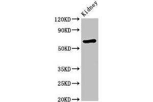 Western Blot Positive WB detected in: Mouse kidney tissue All lanes: STXBP3 antibody at 3. (STXBP3 Antikörper  (AA 266-528))
