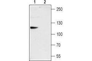 Western blot analysis of rat brain membranes: - 1.