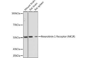 Western blot analysis of extracts of various cell lines, using Neurokinin 1 Receptor (NK1R) (NK1R) Rabbit mAb (ABIN7270711) at 1:1000 dilution. (TACR1 Antikörper)