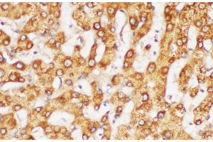 Immunohistochemistry of paraffin-embedded Human liver using FGG Polycloanl Antibody at dilution of 1:200 (FGG Antikörper)