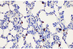 Immunohistochemistry of paraffin-embedded Rat lung using S100a8 Polycloanl Antibody at dilution of 1:200 (S100A8 Antikörper)