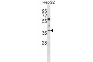 Western Blotting (WB) image for anti-Endonuclease 8-like 2 (NEIL2) antibody (ABIN5018074) (NEIL2 Antikörper)