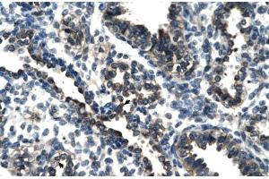 Rabbit Anti-TSC22D4 Antibody Catalog Number: ARP30107 Paraffin Embedded Tissue: Human Lung Cellular Data: Alveolar cells Antibody Concentration: 4. (TSC22D4 Antikörper  (N-Term))