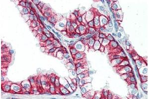 Human Prostate (formalin-fixed, paraffin-embedded) stained with BSG antibody ABIN396957 at 10 ug/ml followed by biotinylated anti-mouse IgG secondary antibody ABIN481714, alkaline phosphatase-streptavidin and chromogen. (CD147 Antikörper)
