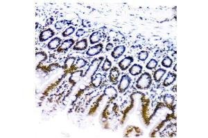 IHC analysis of KAP1/TRIM28 using anti-KAP1/TRIM28 antibody (ABIN7602310).