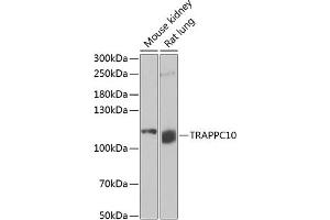 Western blot analysis of extracts of various cell lines, using TR antibody (ABIN6129150, ABIN6149471, ABIN6149472 and ABIN6222518) at 1:1000 dilution.