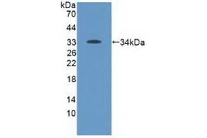 Detection of Recombinant Tyk2, Human using Polyclonal Antibody to Tyrosine Kinase 2 (Tyk2) (TYK2 Antikörper  (AA 915-1173))