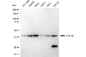 Western blotting analysis using BCKDK antibody (ABIN7797783). (BCKDK Antikörper)