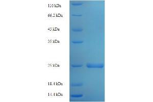 SDS-PAGE (SDS) image for Stromal Cell Derived Factor 2 (SDF2) (AA 19-211) protein (His tag) (ABIN4974460)