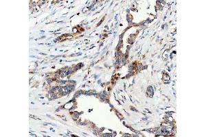 IHC analysis of FOXO3A using anti-FOXO3A antibody (ABIN3042404). (FOXO3 Antikörper  (AA 471-673))
