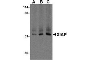 Western blot analysis of XIAP in Human kidney lysate using AP30993PU-N XIAP antibody at 0.