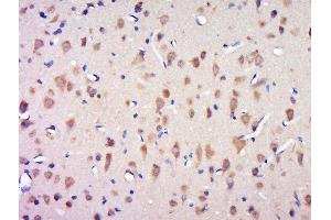 Paraformaldehyde-fixed, paraffin embedded rat brain tissue, Antigen retrieval by boiling in sodium citrate buffer(pH6) for 15min, Block endogenous peroxidase by 3% hydrogen peroxide for 30 minutes, Blocking buffer (normal goat serum) at 37°C for 20min, Antibody incubation with Rabbit Anti-CCDC124 Polyclonal Antibody, Unconjugated  at 1:500 overnight at 4°C, followed by a conjugated secondary and DAB staining (CCDC124 Antikörper  (AA 145-223))