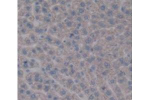 IHC-P analysis of Rat Tissue, with DAB staining. (PYGL Antikörper  (AA 603-750))