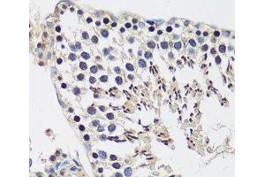 Immunohistochemistry of paraffin-embedded Rat testis using CASC5 Polyclonal Antibody at dilution of 1:100 (40x lens). (CASC5 Antikörper)