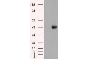 Image no. 1 for anti-CUGBP, Elav-Like Family Member 1 (CELF1) antibody (ABIN1497686) (CELF1 Antikörper)