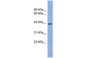 ACPP antibody used at 1 ug/ml to detect target protein. (ACPP Antikörper  (Middle Region))