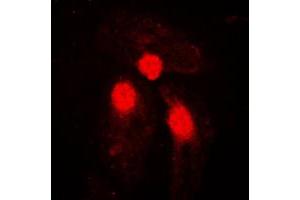 Immunofluorescent analysis of SMAD3 (pS204) staining in HeLa cells. (SMAD3 Antikörper  (pSer204))