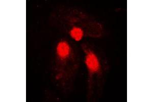 Immunofluorescent analysis of SMAD3 (pS204) staining in HeLa cells.