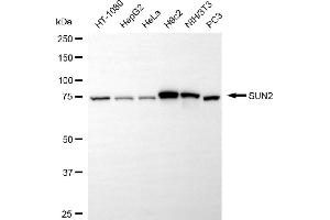 Western blotting analysis using SUN2 antibody (ABIN7800269). (Rekombinanter SUN2 Antikörper)