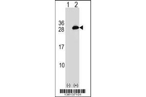 Western blot analysis of UBE2T using rabbit polyclonal UBE2T Antibody using 293 cell lysates (2 ug/lane) either nontransfected (Lane 1) or transiently transfected (Lane 2) with the UBE2T gene.