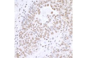 Immunohistochemistry (IHC) image for anti-Breast Carcinoma Amplified Sequence 2 (BCAS2) (C-Term) antibody (ABIN7453423) (BCAS2 Antikörper  (C-Term))