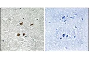 Immunohistochemistry analysis of paraffin-embedded human brain, using HSF1 (Phospho-Ser121) Antibody. (HSF1 Antikörper  (pSer121))