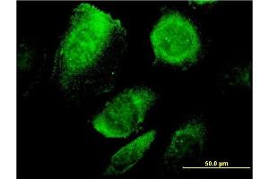 Immunofluorescence of monoclonal antibody to BCAP29 on HeLa cell. (BCAP29 Antikörper  (AA 125-241))