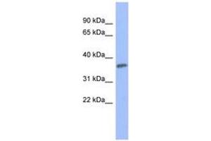 Image no. 1 for anti-Protein Kinase C, gamma (PRKCG) (AA 539-588) antibody (ABIN6741659) (PKC gamma Antikörper  (AA 539-588))