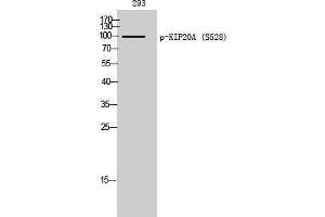Western Blotting (WB) image for anti-Kinesin Family Member 20A (KIF20A) (pSer528) antibody (ABIN3182270) (KIF20A Antikörper  (pSer528))